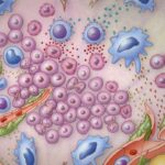 Tumor Microenvironment: Tissue and Cells in Cancer